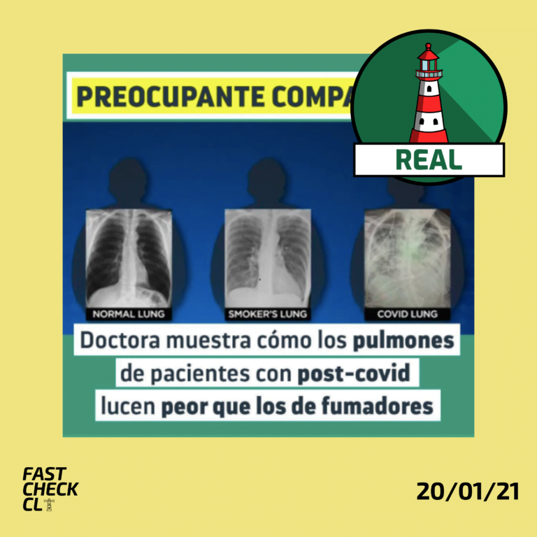 Lee más sobre el artículo (Imagen) “Doctora muestra cómo los pulmones de pacientes post-Covid lucen peor que los de fumadores”: #Real