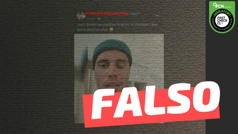 Lee más sobre el artículo Justin Bieber sufre parálisis facial por vacunarse contra el Covid-19: #Falso