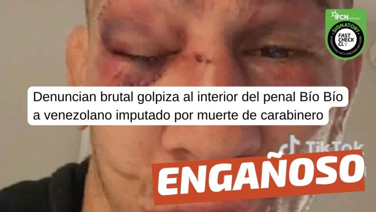 Lee más sobre el artículo (Imagen) “Denuncian brutal golpiza al interior del penal Bío Bío a venezolano imputado por muerte de Carabinero”: #Engañoso